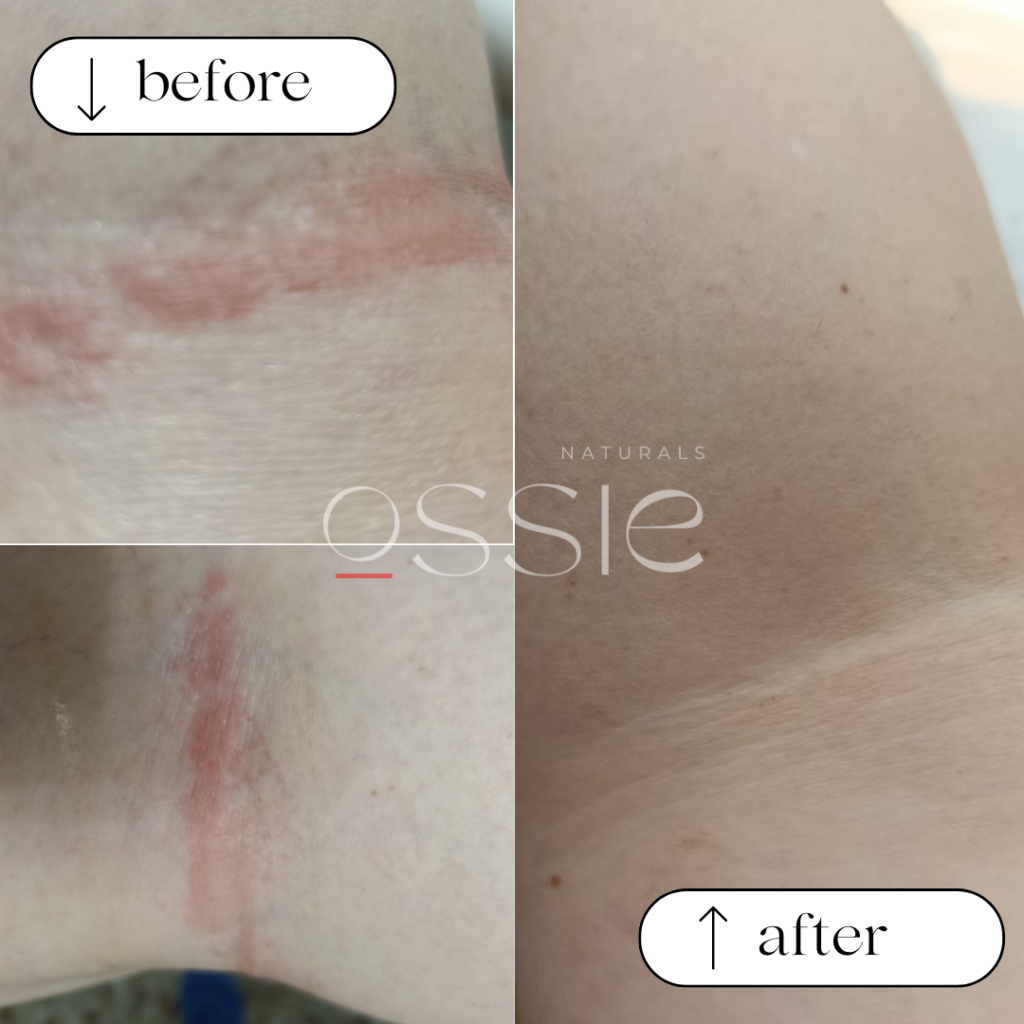 Lorena- Before & After