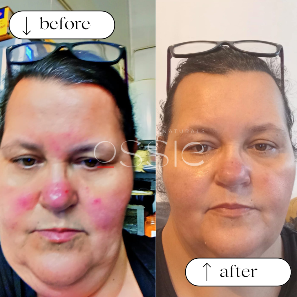 Noemi- Before & After
