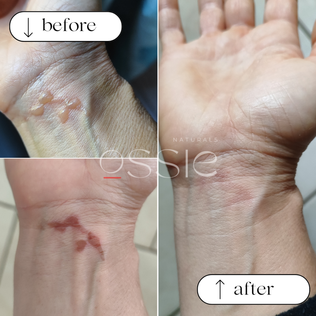 Jes- Before & After